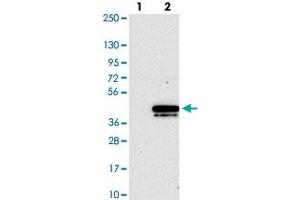 Western blot analysis of Lane 1: Negative control (vector only transfected HEK293T lysate). (CHMP4B 抗体)
