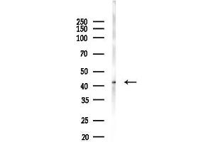 anti-Branched Chain Keto Acid Dehydrogenase E1, alpha Polypeptide (BCKDHA) (pSer292), (pSer337) antibody