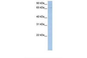 anti-ATP-Binding Cassette, Sub-Family F (GCN20), Member 3 (ABCF3) (AA 38-87) antibody