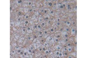 Used in DAB staining on fromalin fixed paraffin- embedded liver tissue (IRS4 抗体  (AA 1-196))