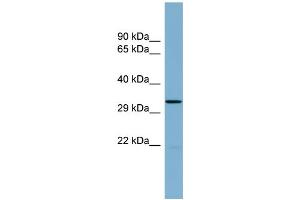 WB Suggested Anti-THG1L Antibody Titration:  0. (THG1L 抗体  (Middle Region))