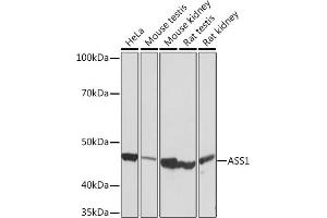 Western blot analysis of extracts of various cell lines, using  Rabbit mAb (ABIN7265669) at 1:1000 dilution. (ASS1 抗体)