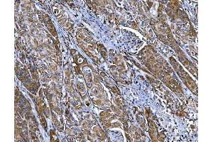 IHC analysis of FRY using anti-FRY antibody (ABIN7599716).