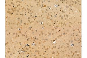 ABIN7094482 and ABIN7098531 at 1/100 staining Rat brain tissue by IHC-P.