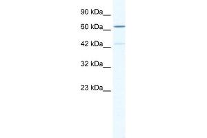 WB Suggested Anti-ZNF419 Antibody Titration:  0. (ZNF419 抗体  (N-Term))
