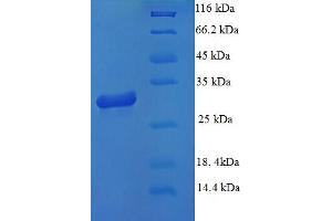 SDS-PAGE (SDS) image for Microtubule-Associated Protein 1S (MAP1S) (AA 794-1053), (partial) protein (His tag) (ABIN5712864)