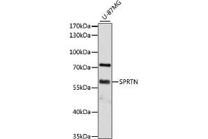 Western blot analysis of extracts of U-87MG cells, using SPRTN antibody (ABIN6131455, ABIN6148388, ABIN6148390 and ABIN6215311) at 1:3000 dilution. (Spartan 抗体  (AA 1-240))
