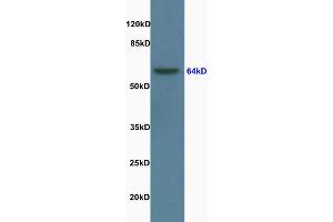 Rat brain lysate probed with Anti Lamin B [Nuclear Envelope Marker] Polyclonal Antibody, Unconjugated (ABIN735203) at 1:200 in 4 °C. (Lamin B1 抗体  (AA 361-460))