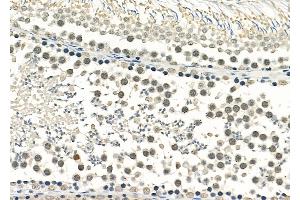 ABIN6259086 and ABIN6275721 at 1/100 staining Rat testis tissue by IHC-P. (Raly 抗体  (Internal Region))