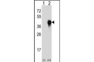 Western blot analysis of PLAUR (arrow) using rabbit polyclonal PLAUR Antibody  (ABIN652429 and ABIN2842227). (PLAUR 抗体  (AA 136-166))