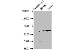 Immunoprecipitating PRSS7 in Jurkat whole cell lysate Lane 1: Rabbit control IgG instead of ABIN7151805 in Jurkat whole cell lysate. (TMPRSS15 抗体  (AA 40-300))