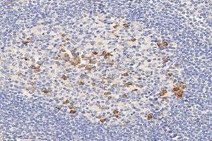 Immunohistochemistry analysis of paraffin-embedded human tonsil using,ME2 (ABIN7074757) at dilution of 1: 6000 (NAD-ME 抗体)