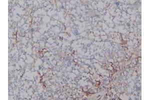 Detection of HPSE in Rat Spinal cord Tissue using Polyclonal Antibody to Heparanase (HPSE)