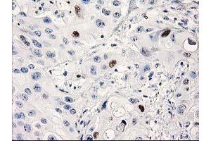 Image no. 6 for anti-Tumor Protein P53 (TP53) antibody (ABIN1499971) (p53 抗体)