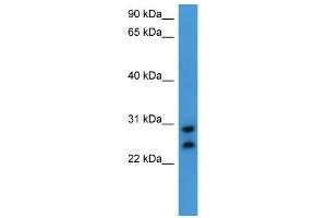 WB Suggested Anti-CEACAM7 Antibody Titration: 0. (CEACAM7 抗体  (C-Term))