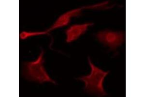 ABIN6278636 staining 293T by IF/ICC. (SRPK3 抗体  (Internal Region))