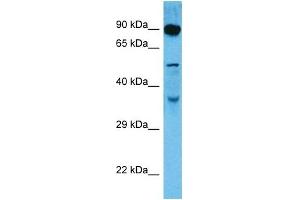 Host:  Rat  Target Name:  DMTF1  Sample Tissue:  Rat Skeletal Muscle  Antibody Dilution:  1ug/ml (DMP1 抗体  (C-Term))