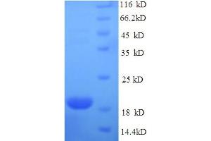 Major Urinary Protein 2 (MUP2) (AA 19-180) protein (His tag)