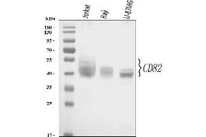 Western blot analysis of CD82 using anti-CD82 antibody (ABIN3043486). (CD82 抗体  (AA 98-267))