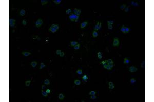 Immunofluorescence staining of HepG2 cells with ABIN7140048 at 1:100, counter-stained with DAPI. (LPPR1 抗体  (AA 51-66))