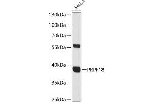 Western blot analysis of extracts of HeLa cells, using PRPF18 antibody (ABIN6132207, ABIN6146254, ABIN6146255 and ABIN6216579) at 1:3000 dilution. (PRPF18 抗体  (AA 1-342))