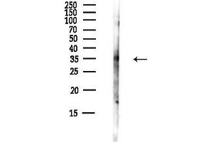 anti-Retinol Dehydrogenase 8 (RDH8) antibody