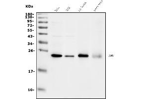 Western blot analysis of RHOF using anti-RHOF antibody (ABIN7601568).