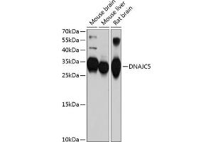 Western blot analysis of extracts of various cell lines, using DN antibody (ABIN6127737, ABIN6139724, ABIN6139725 and ABIN6214762) at 1:1000 dilution. (DNAJC5 抗体  (AA 1-198))