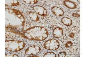 Immunoperoxidase of monoclonal antibody to CES2 on formalin-fixed paraffin-embedded human colon. (CES2 抗体  (AA 514-621))