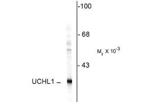 Image no. 1 for anti-Ubiquitin Carboxyl-terminal Esterase L1 (Ubiquitin Thiolesterase) (UCHL1) antibody (ABIN372739) (UCHL1 抗体)
