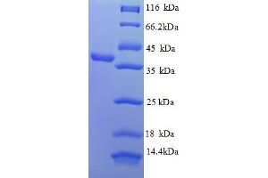 SDS-PAGE (SDS) image for Apurinic/Apyrimidinic Endonuclease 1 (APEX1) (AA 32-318) protein (His tag) (ABIN5709055)