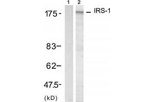 Western blot analysis of extract from 293 cell, using IRS-1 (Ab-312) Antibody (E021166, Lane 1 and 2). (IRS1 抗体)