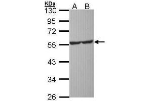 WB Image Sample (30 ug of whole cell lysate) A: Molt-4 , B: Raji 10% SDS PAGE antibody diluted at 1:1000 (Serotonin Receptor 1A 抗体)