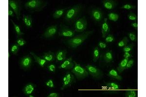 Immunofluorescence (IF) image for anti-Adrenocortical Dysplasia Homolog (ACD) (AA 1-544) antibody (ABIN566298)