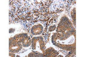 Immunohistochemistry (IHC) image for anti-Ciliary Neurotrophic Factor Receptor (CNTFR) (AA 190-340) antibody (ABIN6219761) (CNTF Receptor alpha 抗体  (AA 190-340))