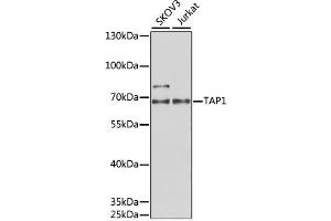 Western blot analysis of extracts of various cell lines, using TAP1 antibody (ABIN1882340) at 1:1000 dilution. (TAP1 抗体)