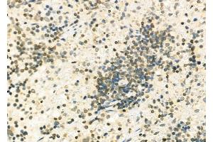 ABIN6263652 and ABIN6279502 at 1/100 staining Rat spleen tissue by IHC-P. (NKX6-2 抗体)