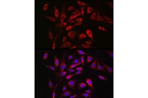 Immunofluorescence analysis of NIH/3T3 cells using SOCS3 Rabbit pAb (ABIN3015316, ABIN3015317, ABIN5663764 and ABIN6213984) at dilution of 1:50 (40x lens). (SOCS3 抗体  (C-Term))