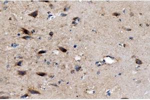 IHC analysis of AKR7A2 using anti-AKR7A2 antibody (ABIN7601157).