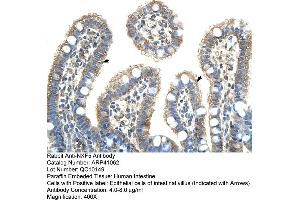 Rabbit Anti-NXF5 Antibody  Paraffin Embedded Tissue: Human Intestine Cellular Data: Epithelial cells of intestinal villas Antibody Concentration: 4. (NXF5 抗体  (Middle Region))