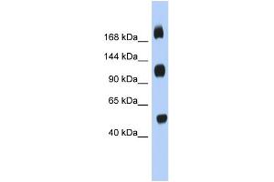 WB Suggested Anti-C2orf55 Antibody Titration: 0. (C2orf55 抗体  (Middle Region))