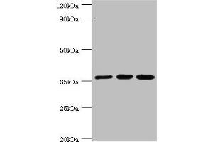 Western blot All lanes: Glutaredoxin-3 antibody at 10 μg/mL Lane 1: Rat brain tissue Lane 2: HepG2 whole cell lysate Lane 3: Hela whole cell lysate Secondary Goat polyclonal to rabbit IgG at 1/10000 dilution Predicted band size: 37 kDa Observed band size: 37 kDa (GLRX3 抗体  (AA 1-335))