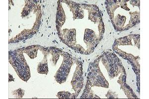 Image no. 3 for anti-Protein Disulfide Isomerase Family A, Member 3 (PDIA3) (AA 140-505) antibody (ABIN1490935)