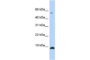WB Suggested Anti-CXCL6 Antibody Titration: 0. (CXCL6 抗体  (Middle Region))