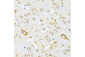 Immunohistochemistry of paraffin-embedded mouse brain using VARS antibody (ABIN1683239, ABIN3018665, ABIN3018666 and ABIN6220533) at dilution of 1:100 (40x lens). (VARS 抗体  (AA 1-280))