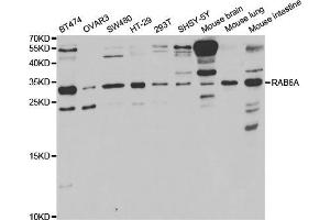 Western blot analysis of extracts of various cell lines, using RAB6A antibody (ABIN5973269) at 1/1000 dilution. (RAB6A 抗体)
