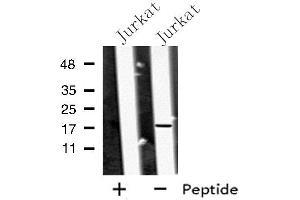 Western blot analysis of MED9 using Jurkat whole cell lysates (MED9 抗体  (Internal Region))