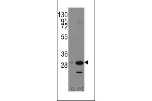 Western blot analysis of PHB1 using rabbit polyclonal PHB1 Antibody (Human C-term) using 293 cell lysates (2 ug/lane) either nontransfected (Lane 1) or transiently transfected with the PHB1 gene (Lane 2). (Prohibitin 抗体  (C-Term))