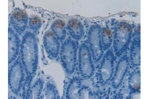 Detection of HSPBP1 in Rat Intestine Tissue using Polyclonal Antibody to Heat Shock 70 kDa Binding Protein 1 (HSPBP1)