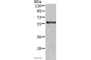Western blot analysis of Rat kidney tissue, using ALDH6A1 Polyclonal Antibody at dilution of 1:450 (ALDH6A1 抗体)